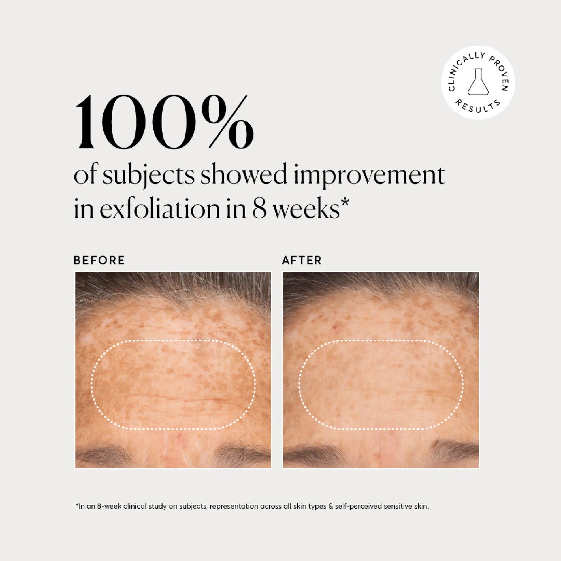 bha-liquid-exfoliant-2-k1 NATR-10027-Alt-Images-BHA-Liquid-Exfoliant-2_-03.webp